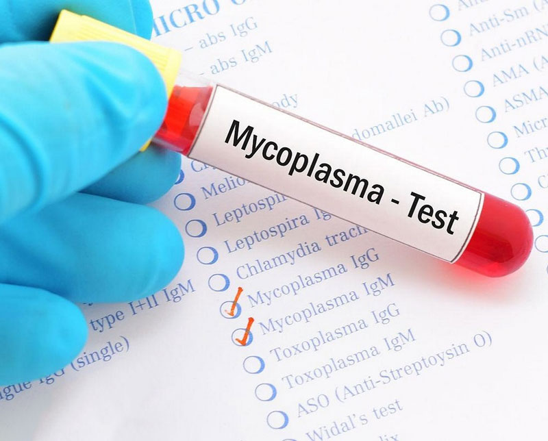 Médico entrega recomendaciones tras confirmarse deceso de menor por bacteria mycoplasma
