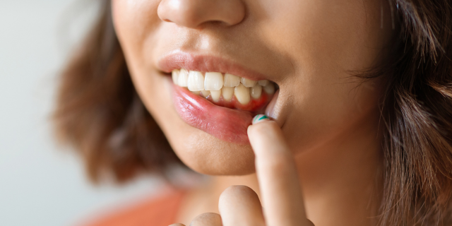 Día Mundial de la Salud Bucodental: Una mala salud bucodental puede generar graves enfermedades cardíacas, pulmonares o agravar la diabetes